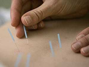 Acupuncture Proven to Help Treat Spinal Cord Injuries
