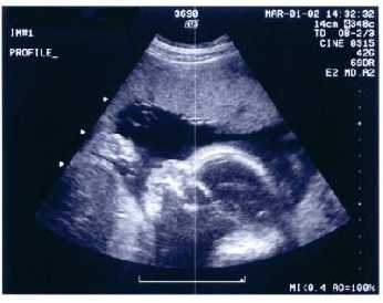 A Quick Guide On How To Get Pregnant