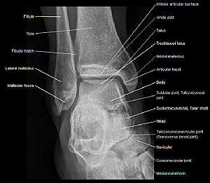 Ankle Joint Antero-Posterior View