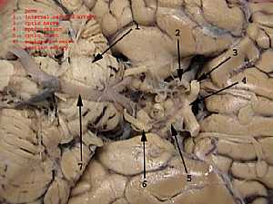 Occulomotor nerve anatomy