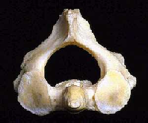 The Axis vertebra