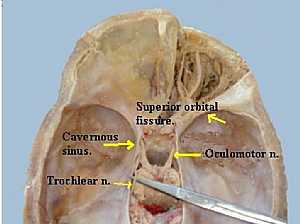 occulomotor and trochlear nerve anatomy