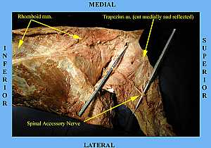 Spinal accessory nerve anatomy