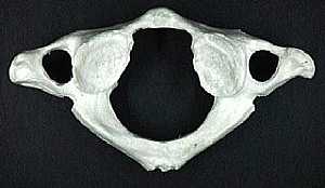 The Atlas vertebra