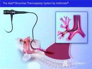 FDA Approves New Device for Adults with Severe and Persistent Asthma