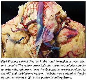 Abducent Nerve anatomy