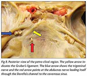 Abducent and Trigeminal nerve anatomy