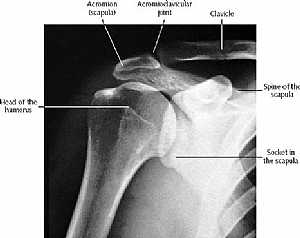 Shoulder Joint X-Ray
