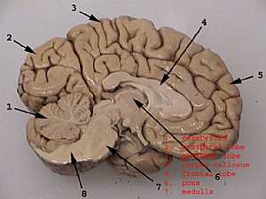 Cerebral hemisphere 2