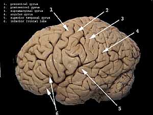 Cerebral hemisphere