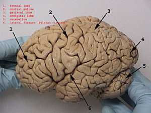 Cerebral hemisphere