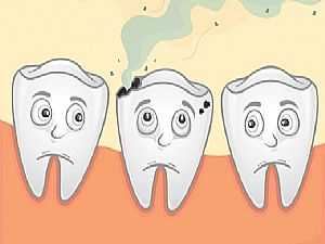 تعرف على 10 علاجات منزلية تساعدك في التخلص من "تسوس الأسنان"