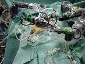 أطباء يجرون عمليات جراحية علي الإنسان الآلي