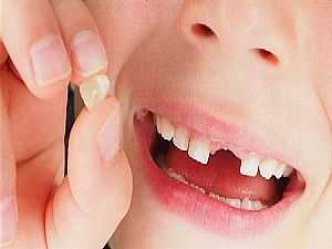 دراسة: الأسنان اللبنية تكشف عن الحالة النفسية لطفلك
