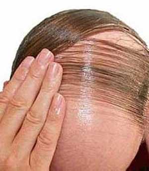 أدوية لنمو الشعر من جديد تحيي أمال الصلع